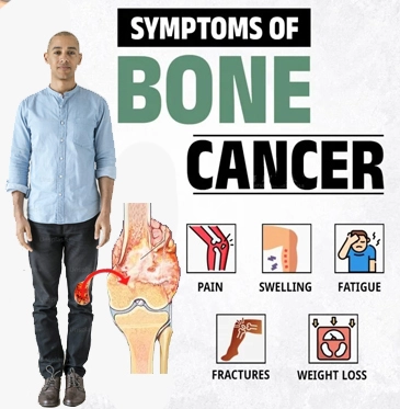 Understanding Pediatric Bone Cancer: Symptoms, Treatment, And Care